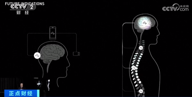 去掉部分头骨，植入芯片！马斯克又有新动作！面向全球招收