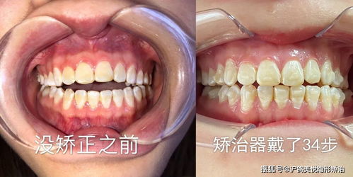 短剧特工千金掉马了免费在线观看_特工小姐归来短剧免费观看--第1张
