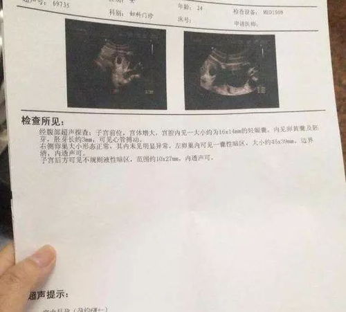 短剧离婚后她转身收到六胎孕检单全集观看_离婚后我开始转运123--第1张