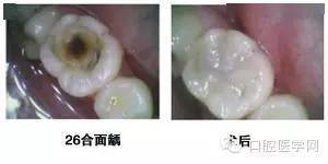  哪里收购绿化树？了解市场行情，选择优质供应商--第1张