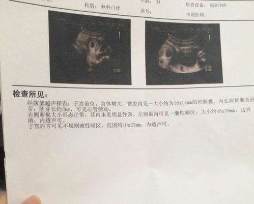  离婚后她转身收到六胎孕检单全集观看--第1张