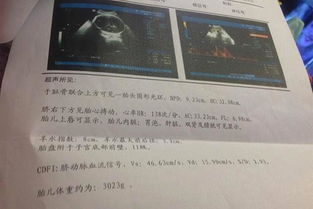 离婚后她转身收到六胎孕检单短剧全集在线观看  离婚后她转身收到六胎孕检单短剧全集在线观看，离婚后她转身收到六胎孕检单短剧全集在线观看，离婚后的惊喜产检结果--第1张