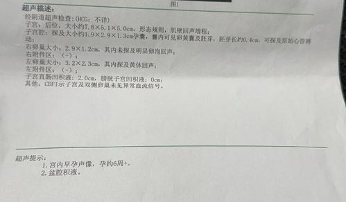 离婚后她转身收到六胎孕检单短剧最新离婚后她转身收到六胎孕检单短剧资讯--第1张