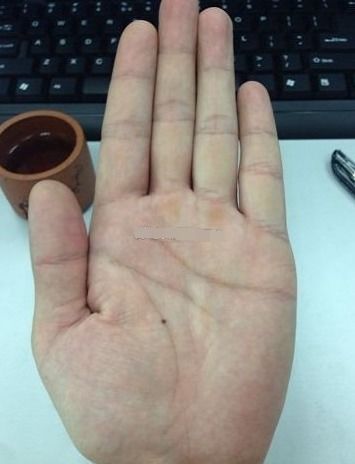 掌心刺与掌心痣，一段深情缠绵的爱情故事--第1张