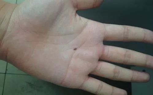 你是我掌心的刺短剧全集剧情信息 你是我的掌心痣全文免费阅读--第1张