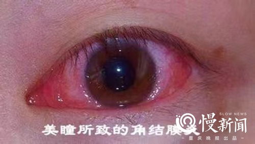 黄金冥瞳，神秘双眼的短剧揭秘--第1张