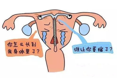 出血原因揭秘，究竟是什么导致的？--第1张